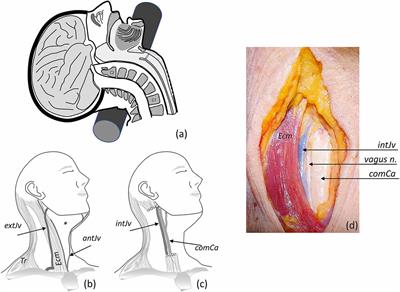 Ex vivo, in situ perfusion protocol for human brain fixation compatible with microscopy, MRI techniques, and anatomical studies